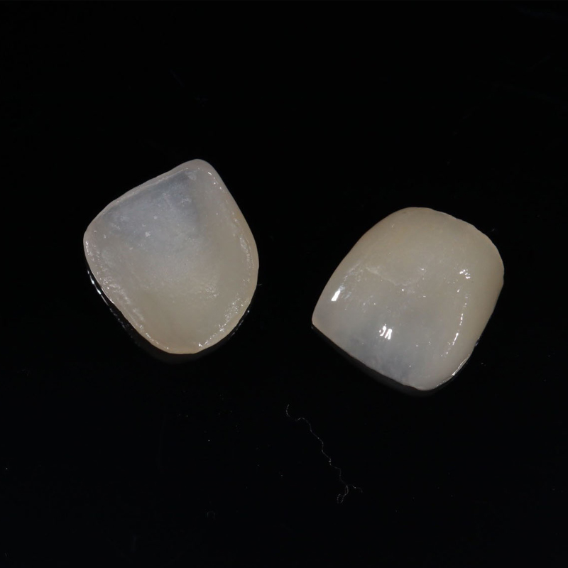 Characteristics of IPS e.max Press
